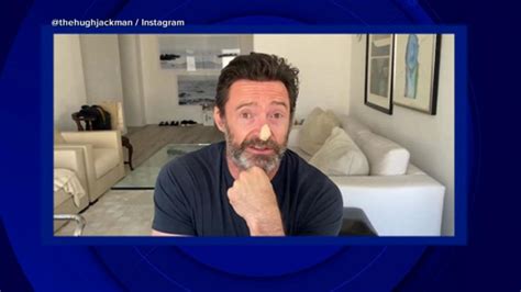 Hugh Jackman urges fans to use sunscreen after skin cancer scare